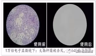 有痔瘡無需手術,這個簡單的方法讓你告別有痔的困擾！！