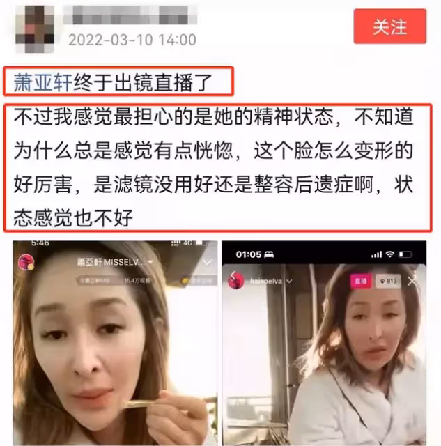 蕭亞軒受傷一年首出鏡，疤痕明顯精神飄忽，滿臉憔悴狀態堪憂