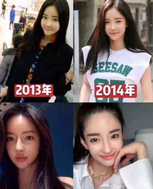 「塑料美人」潘南奎,花十億整成baby,情史混亂插足閨蜜感情?