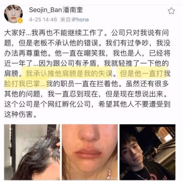「塑料美人」潘南奎,花十億整成baby,情史混亂插足閨蜜感情?