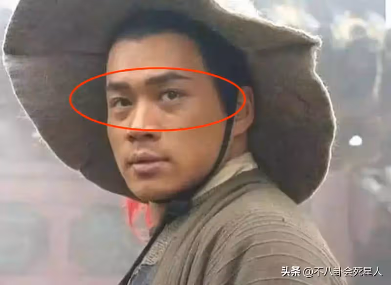 明星熱衷割眼袋，有人立馬年輕20歲，有人卻僵到笑不出來