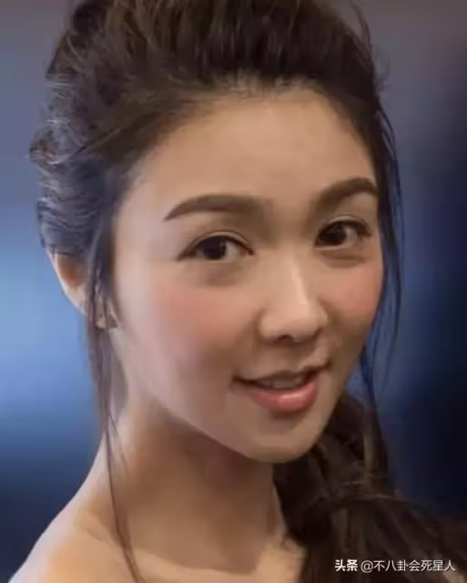 明星熱衷割眼袋，有人立馬年輕20歲，有人卻僵到笑不出來