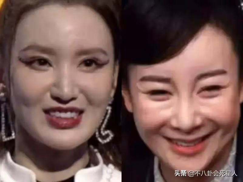 假體亂飛、笑比哭還難看!動臉後的「矽膠臉」才是最恐怖的