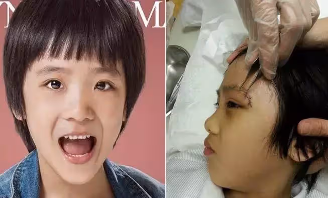 吳鎮宇兒子近照曝光！13歲費曼「五官越長越像爸」暴風抽高 「眼角傷疤超明顯」 網直呼：太心疼