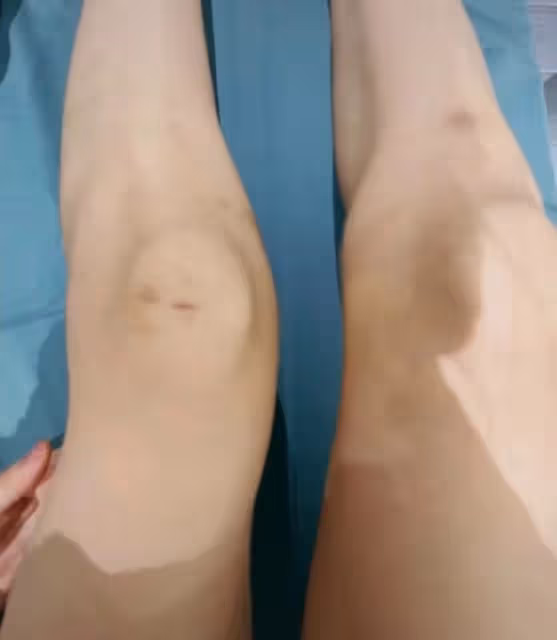 美女網紅遭男友家暴,對方為維護小三狂扇女友巴掌,女方受傷嚴重