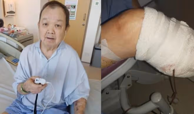 84歲老戲骨唐琥截肢後靠輪椅代步,稱比死還痛苦,感覺在連累家人