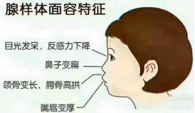 伊能靜罕曬5歲女兒正臉,米粒齙牙突出嘴唇略厚,被疑腺樣體肥大