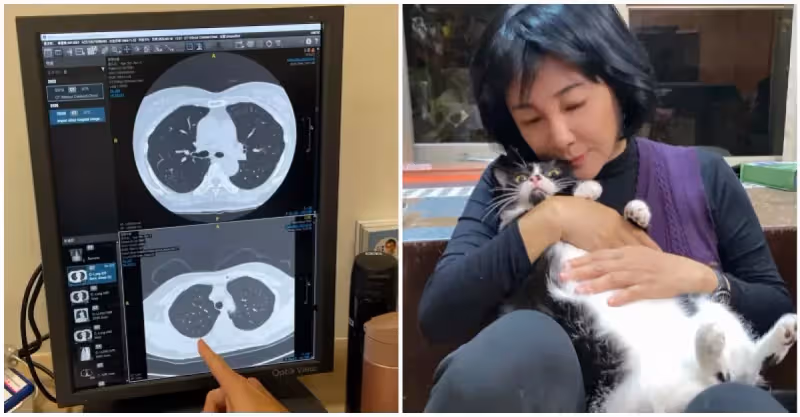 媽媽因肺癌離世！吳淡如健檢「肺部有20個白點」苦嘆：表親不抽菸也罹癌　吐心聲「反而感謝這結果」