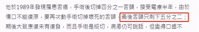 64歲知名主持人去世！患舌癌切除大部分舌頭，一身病痛飽受折磨