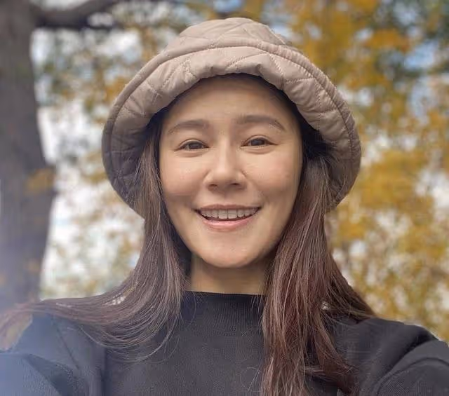 TVB知名女星陷入整容風波！本人親自否認，停工半年後正式復工