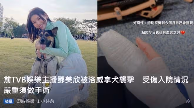 28歲女星被不栓繩大狗咬傷!現場有大灘血跡,傷勢嚴重需動手術