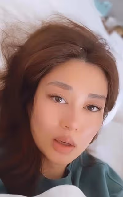 香港知名女星再陷整容疑雲！嘴唇像打了豐唇針，網友：老了20歲
