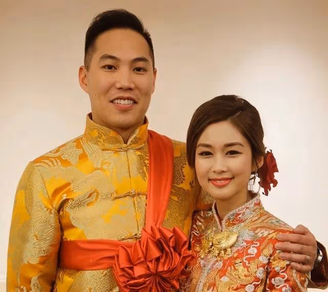 香港知名女星再陷整容疑雲！嘴唇像打了豐唇針，網友：老了20歲
