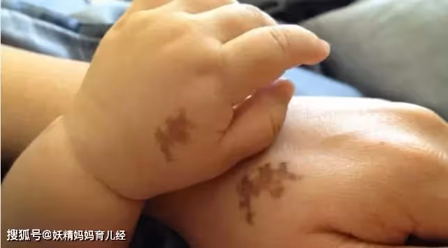 是巧合？閨蜜女兒手上的「特殊胎記」和老公一模一樣 妻子「得知真相後」瞬間崩潰