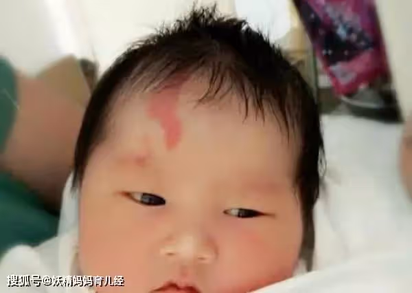 是巧合？閨蜜女兒手上的「特殊胎記」和老公一模一樣 妻子「得知真相後」瞬間崩潰