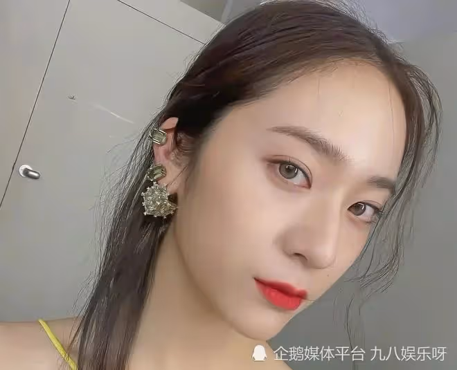 明星也有脫髮困擾？鄭秀晶近照髮際線堪憂，多位女星曾自曝假髮片