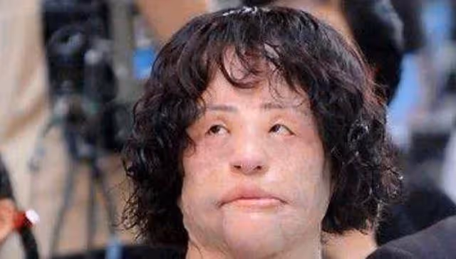 2018年韓慧景去世,年輕時因整容過度幾乎毀容,她到底經歷了什麼
