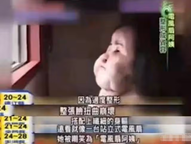 2018年韓慧景去世,年輕時因整容過度幾乎毀容,她到底經歷了什麼