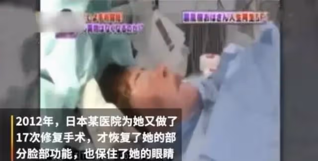 2018年韓慧景去世,年輕時因整容過度幾乎毀容,她到底經歷了什麼