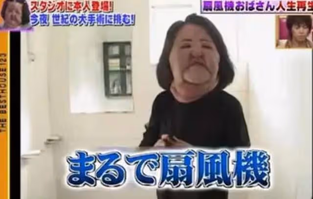 2018年韓慧景去世,年輕時因整容過度幾乎毀容,她到底經歷了什麼