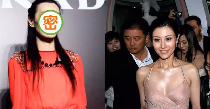 瘦成皮包骨、青筋凸出，9位脫相式衰老的女星，今昔對比差距大
