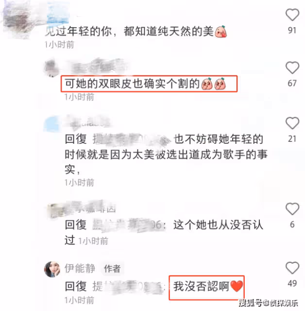 53歲伊能靜首曝「額頭疤痕」由來！否認是整容後遺症　大方承認「割過雙眼皮」不覺丟人