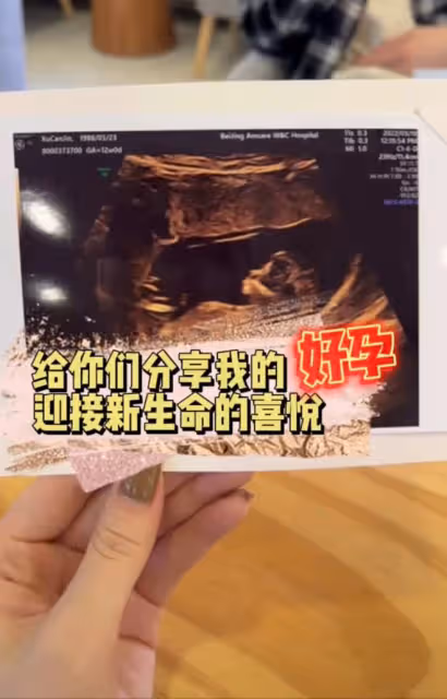 高曉松34歲前妻官宣懷二胎！嫁帥哥再婚不到1年，大女兒已經14歲