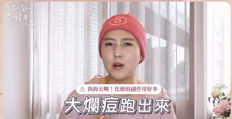 賈靜雯弟媳化療後露面！眉毛稀疏化濃妝遮掩，胸口大塊疤搶鏡
