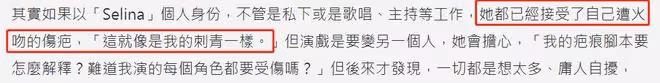 任家萱燒傷10年首度拍戲，稱已接受身上疤痕！俞灝明轉型成實力派