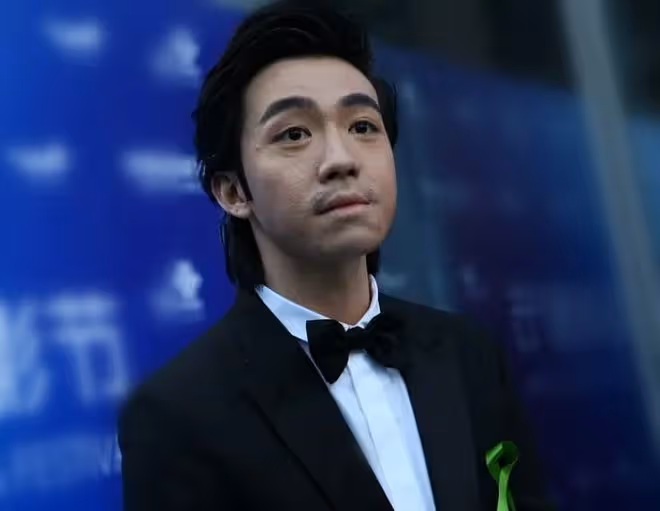 任家萱燒傷10年首度拍戲，稱已接受身上疤痕！俞灝明轉型成實力派