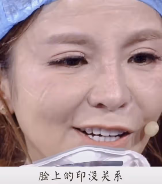 朱迅含淚致敬醫護人員,穿5分鐘防護服滿臉勒痕,吹手套自嘲外行