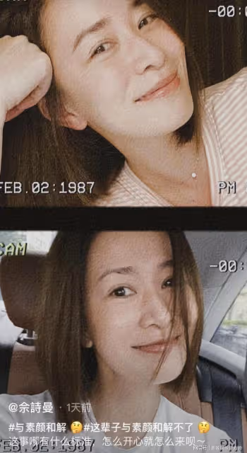 51歲李嘉欣罕曬素顏照,嘴唇發紫毛孔粗大,倆月前緊急住院險喪命