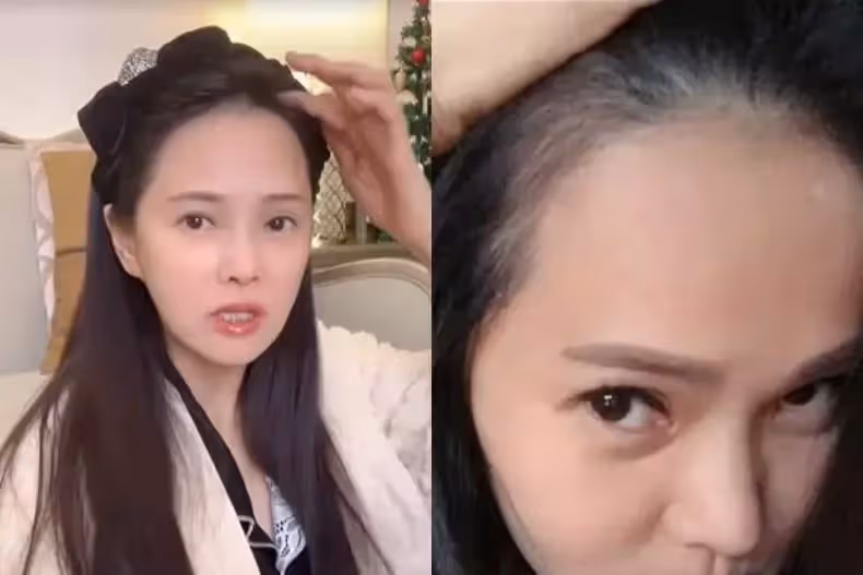 自曝曾有禿頭危機,伊能靜:我的樂趣就是美!53歲像25歲,養氣補血抗衰老5招秘訣公開
