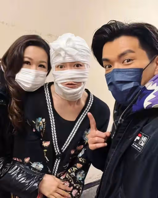 大犧牲!TVB知名女星真素顏上陣拍劇,獲網友大讚:不化妝更美