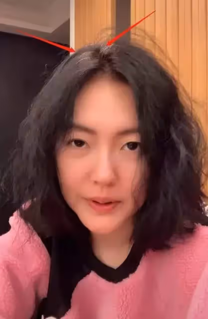 小S近照大變樣，頭頂長白髮滄桑好多，開十級磨皮都遮不住木偶紋，網友大呼：完全認不出！
