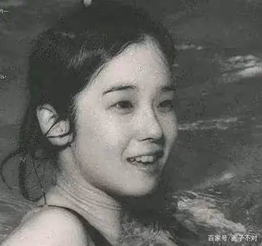 2018年韓慧景去世,年輕時在臉上注射色拉油,因整容過度幾乎毀容