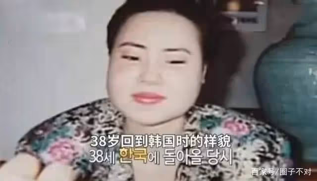 2018年韓慧景去世,年輕時在臉上注射色拉油,因整容過度幾乎毀容