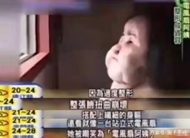 2018年韓慧景去世,年輕時在臉上注射色拉油,因整容過度幾乎毀容