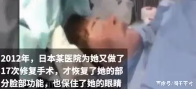 2018年韓慧景去世，年輕時在臉上注射色拉油，因整容過度幾乎毀容