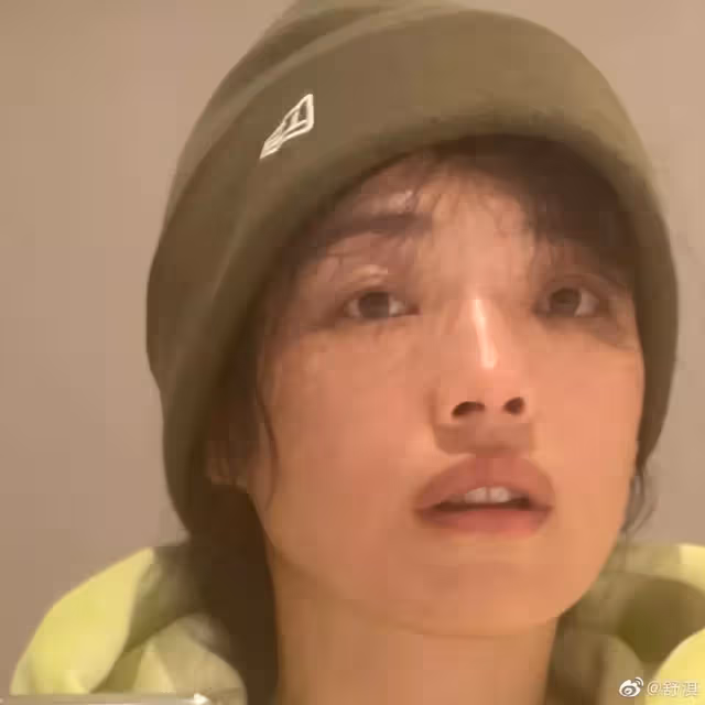 差點認不出來！昔日女神「隱疾纏身2個月」大崩潰　突曬45歲狀態「滿臉憔悴」嚇壞網友