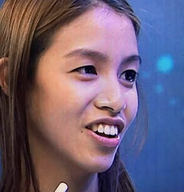 港姐冠軍雷莊兒再度選美，整牙後顏值提升，但已跟牙醫男友分手