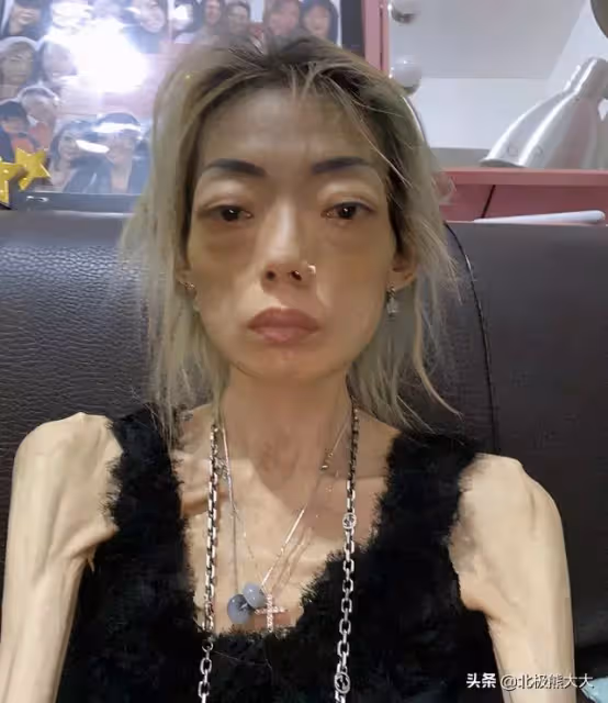 22歲放棄牛津!嫁豪門8年「為討好丈夫」瘦到只剩44斤 現狀曝光:不愛自己的人過不好這一生
