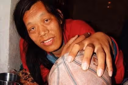 因沒錢治療癱瘓數十年,靠70歲母親拾荒為生的他,如今怎麼樣了?