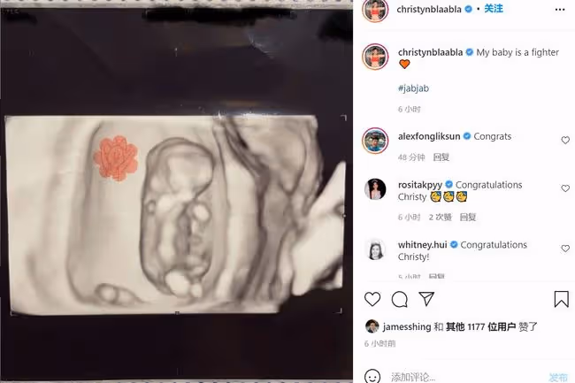 恭喜！劉碧麗力捧女星宣布懷孕，上月才結婚，姨媽是金牌綠葉元秋