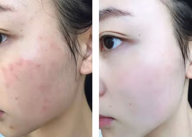 劉亦菲「天仙」人設終於崩了?與陳曉「熱戀」曝光,私密吻照還被偷拍…
