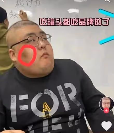 吃播網紅有多危險？說話大喘氣，網友勸停，29歲就離開人世