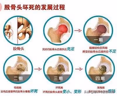 歌王劉歡退居幕後,居然是骨病作怪!身體這些變化,一定要警惕
