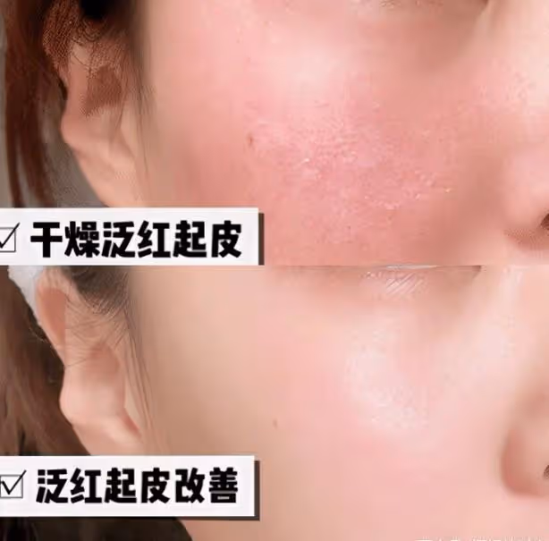 張馨予曬「合影」秀恩愛,「肌膚」白皙被贊,大方曬出自用面霜