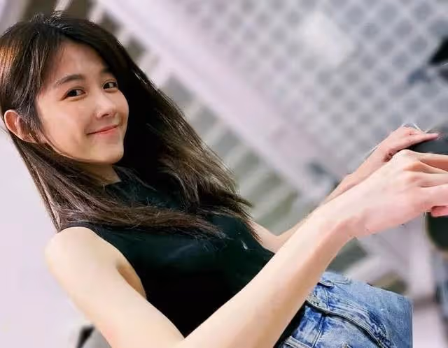 飛來橫禍！31歲女星不慎被推車撞頭當場想吐，醫生證實眼角撕裂