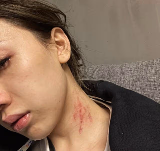 女星慘遭男友家暴!被掐著脖子打滿是血痕,男方出軌染病劣跡斑斑